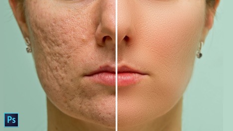 Make your skin look like baby Skin