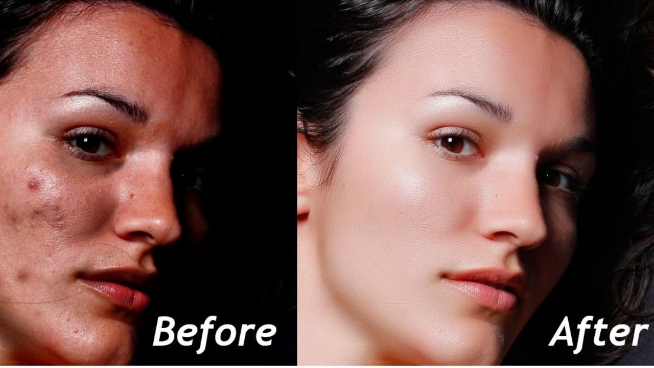 skin-retouching-service-bangladesh